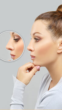 Rhinoplastie