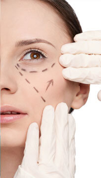 blépharoplastie
